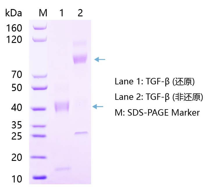 TGF-β1蛋白SDS-PAGE結(jié)果